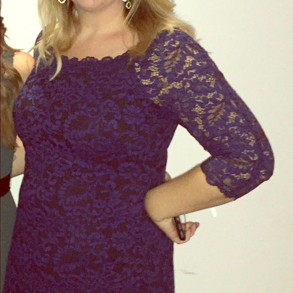 💙 Blue Lace Cocktail Dress 💙